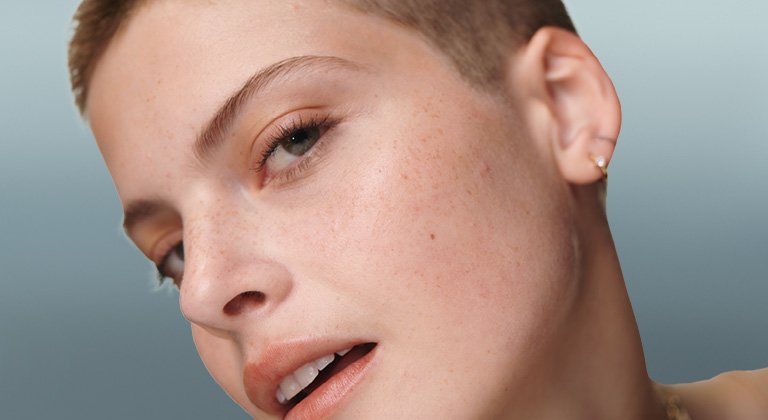 Τι να κάνω για να φύγουν τα σπυράκια;