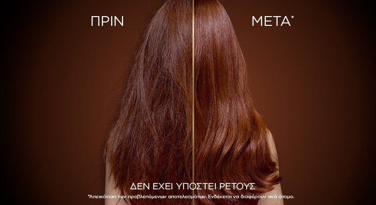 Έχω λιπαρά μαλλιά: Τι να κάνω;