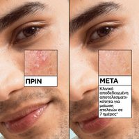 Pure Active Salicylic Anti-Blemish Ορός για Σημάδια Ακμής