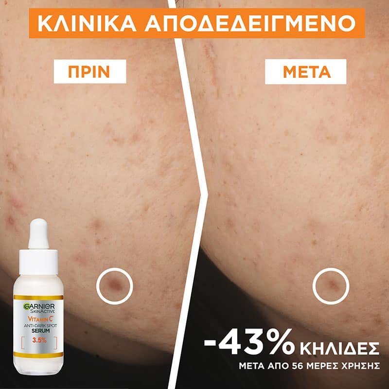 VITAMIN C Ορός Λάμψης με Βιταμίνη C, Νιασιναμίδη & Σαλικυλικό Οξύ Before/After